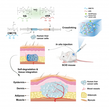 Schematic illustration of the preparation procedures of high-density human liver cancer cell–encapsulated CMCTs/oHA injectable hydrogel and their in vivo application.
